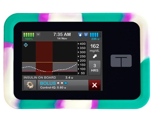 Tandem T:SLIM Pump Gel Skin Case | Sugar Medical