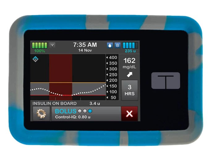 Tandem T:SLIM Pump Gel Skin Case | Sugar Medical