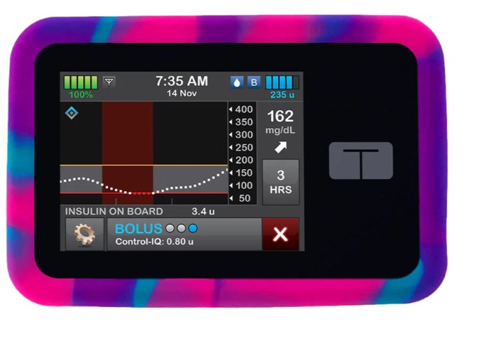 Tandem T:SLIM Pump Gel Skin Case | Sugar Medical