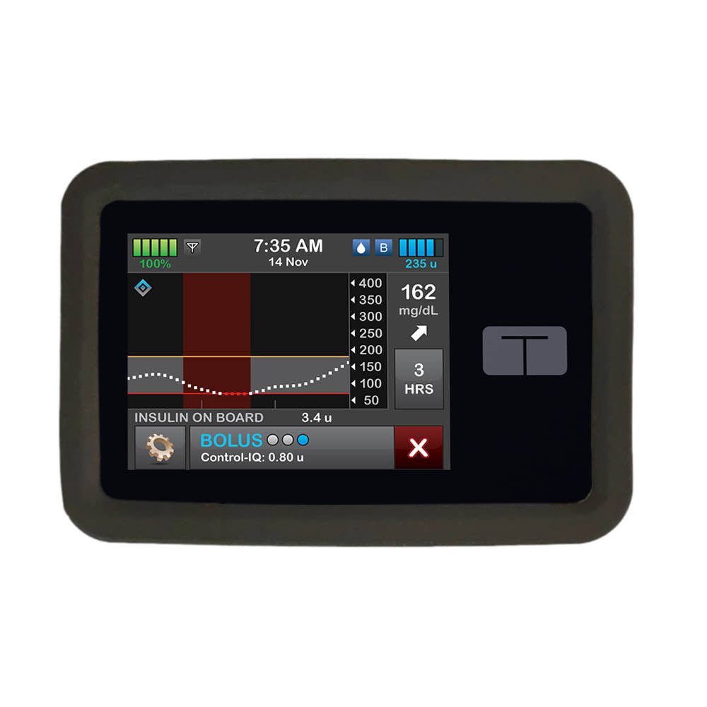 Tandem T:SLIM Pump Gel Skin Case | Sugar Medical